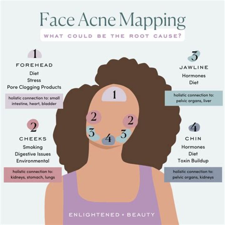 How do I stop pimples on my face?