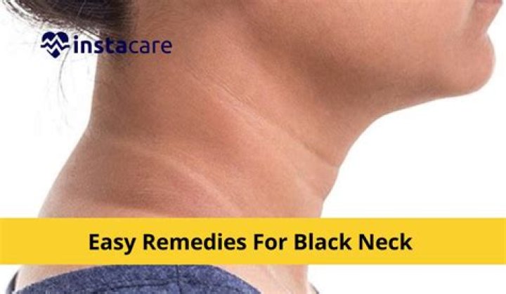 How do potatoes get rid of black neck?