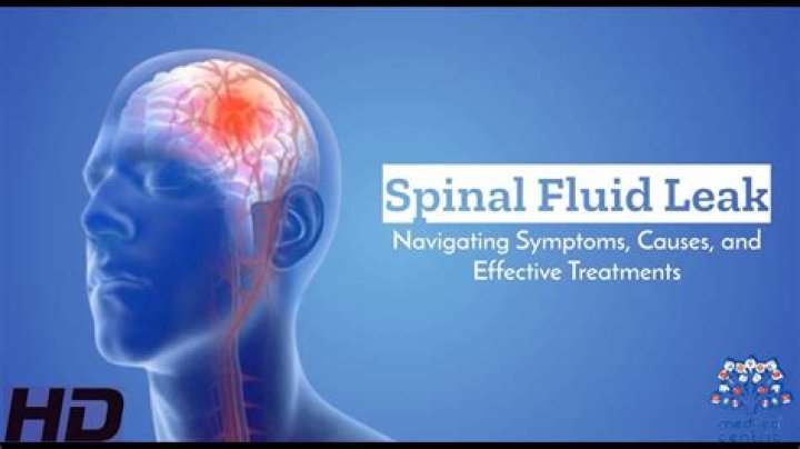 How do you check for spinal fluid leak?