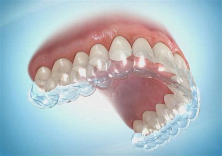 How do you clean clear plastic retainers?