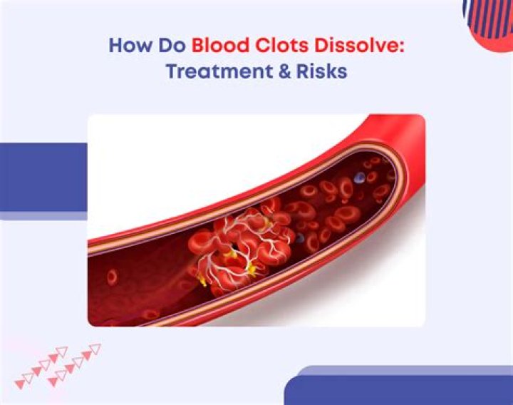 How do you dissolve blood clots fast?