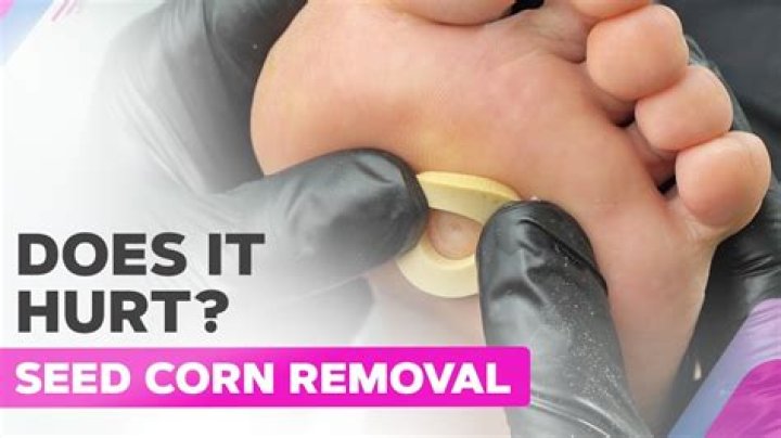 How do you extract seeds from corn?