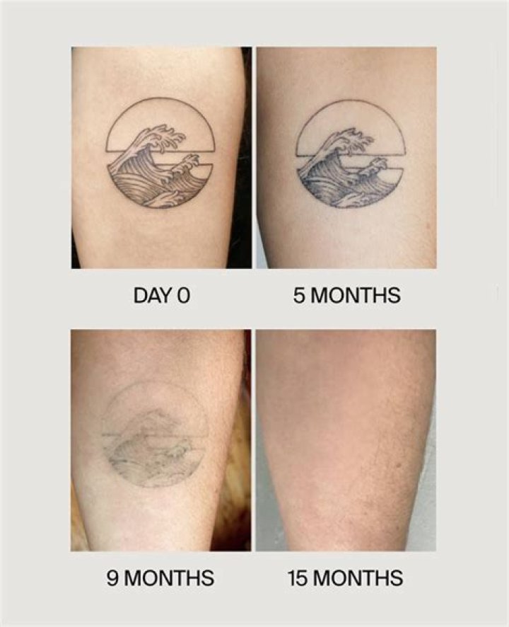 How do you fade a tattoo?