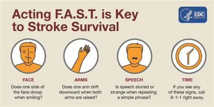 How do you feel just before a stroke?