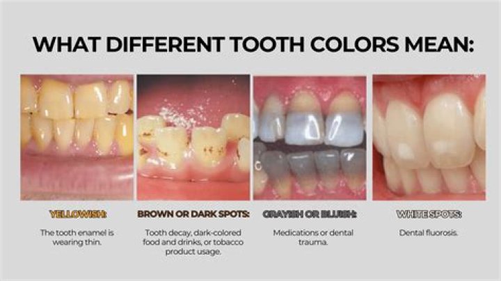 How do you fix discolored gold?