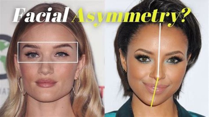 How do you fix facial asymmetry naturally?