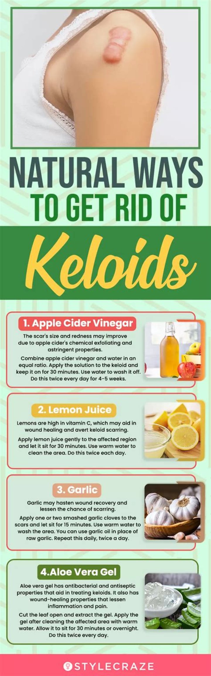 How do you flatten a keloid naturally?