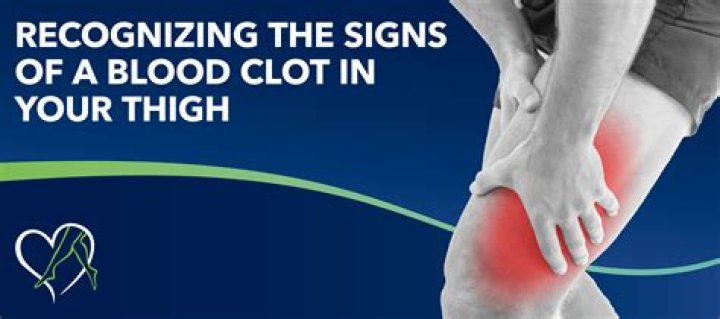 How do you get rid of a blood clot in your nose?