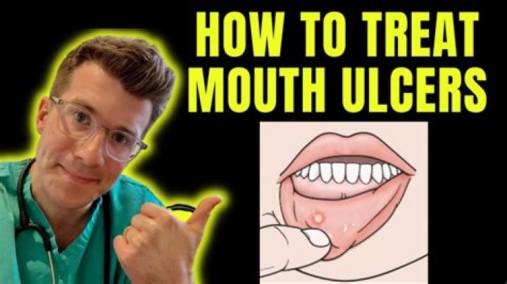 How do you get rid of an STD in the mouth?
