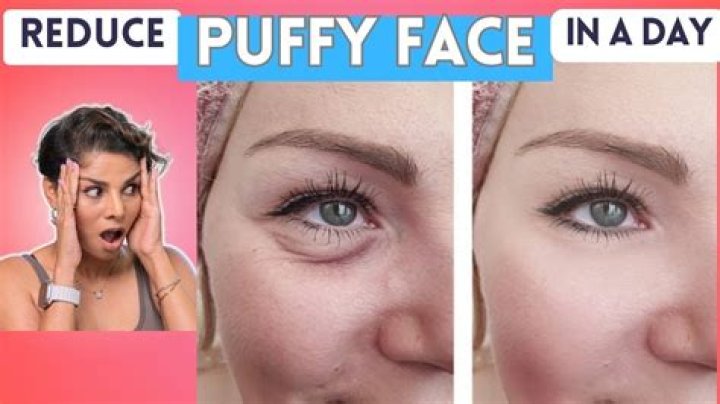 How do you get rid of puffy face from drinking?
