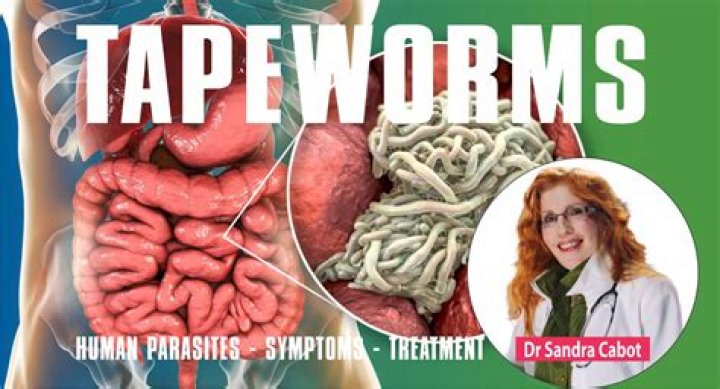How do you get rid of tapeworms in humans?
