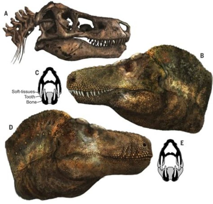 How do you know if you have a thick skull?