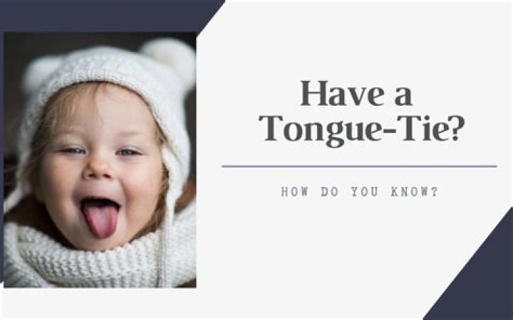 How do you know tongue-tie?
