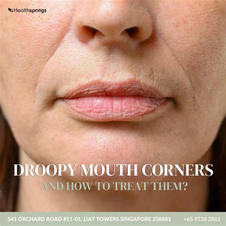 How do you lighten the dark corners of your mouth?