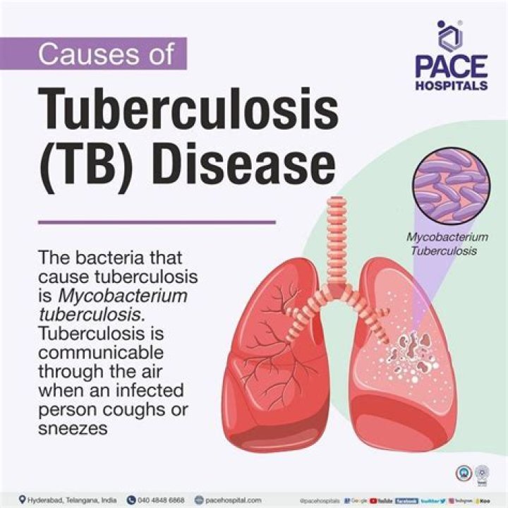 How do you look when you have tuberculosis?