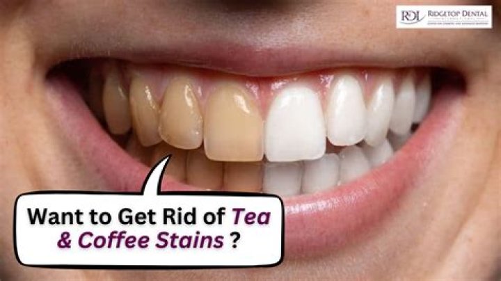 How do you prevent coffee from turning your teeth yellow?