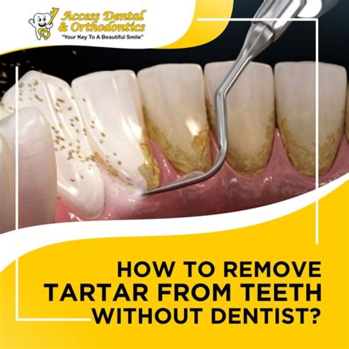How do you remove yellow tartar from your teeth?