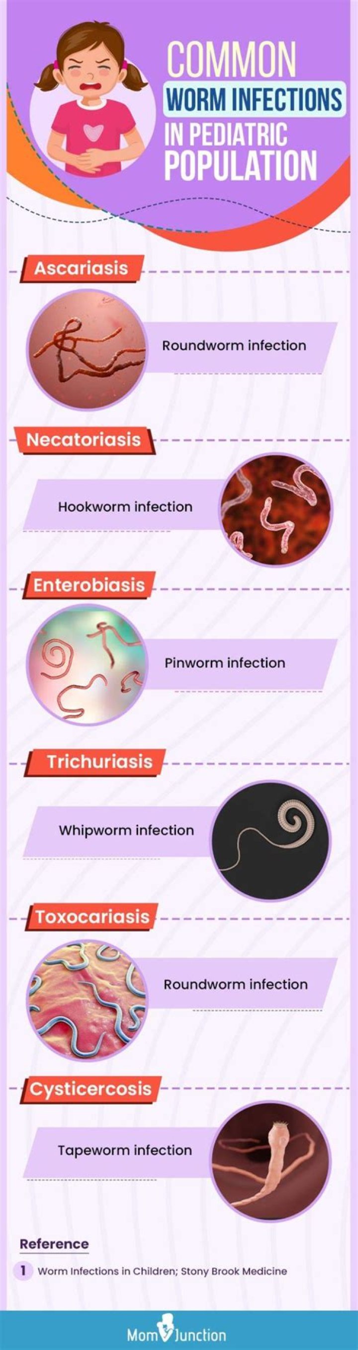 How do you test for pinworms?