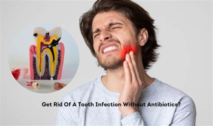 How do you treat an ear infection without antibiotics?