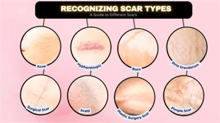 How do you treat scar discoloration?