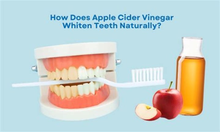How does apple cider vinegar whiten teeth?