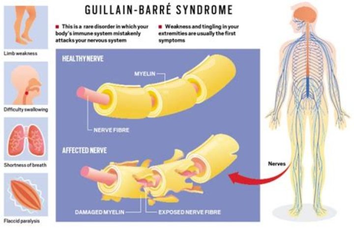 How does Guillain Barre affect the brain?