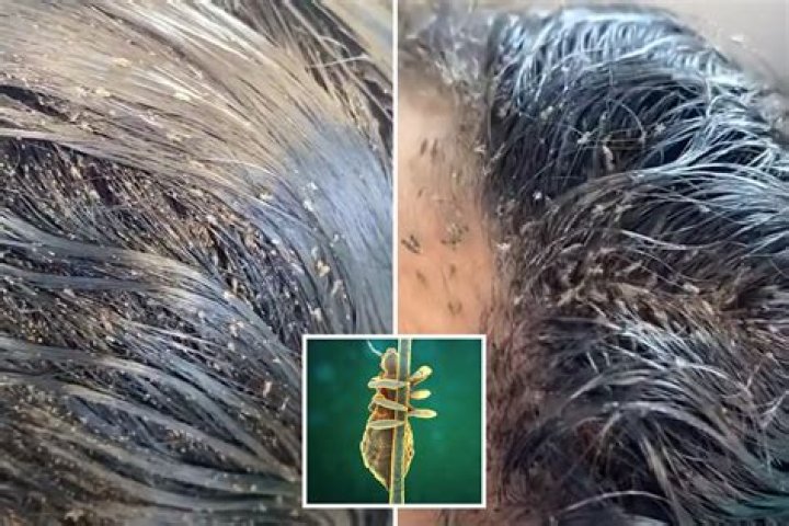 How fast do lice crawl?