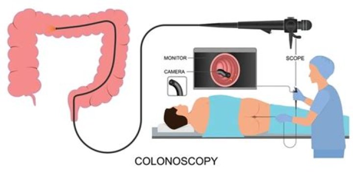 How is a colonoscopy done on a woman?