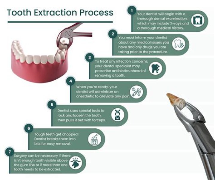 How is a surgical tooth extraction performed?
