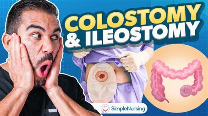 How long after a stoma surgery Can you swim?