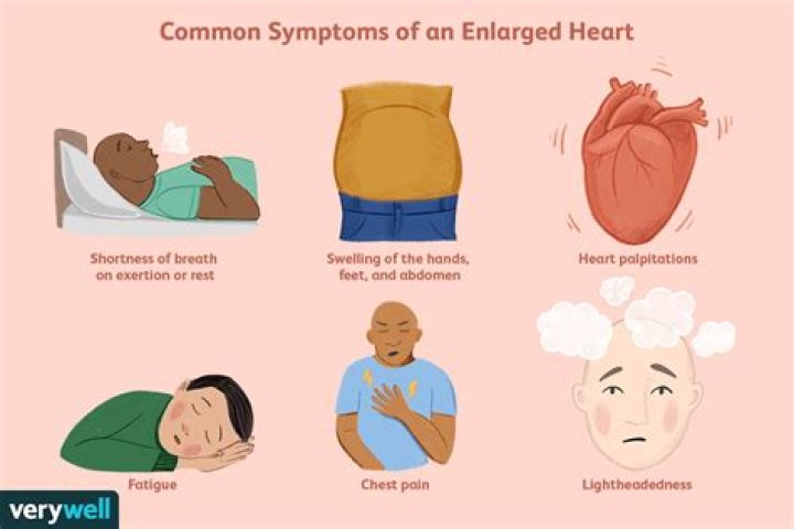 How long can someone live with an enlarged heart?