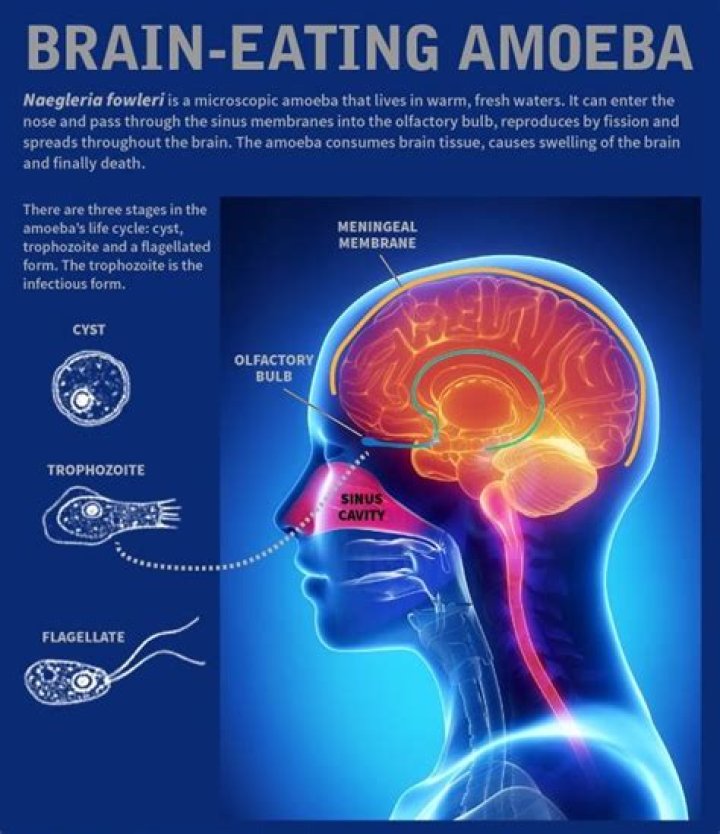 How long can you live with brain-eating amoeba?