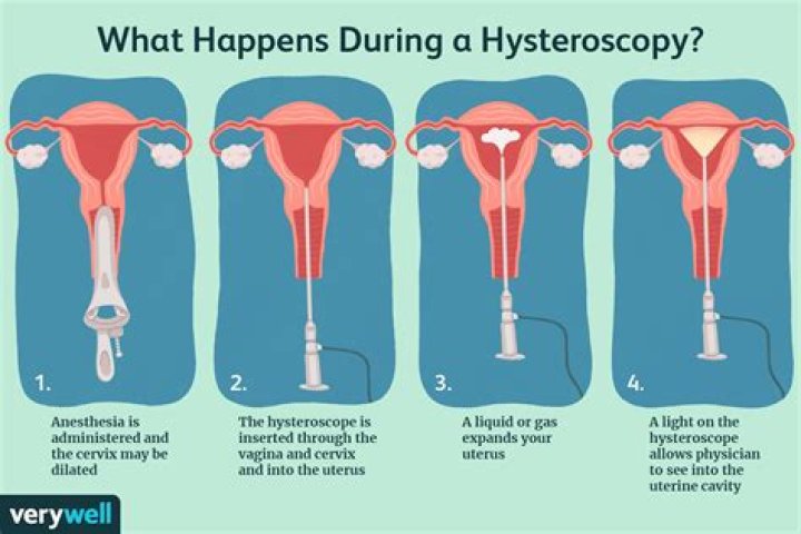 How long do colposcopy results take?