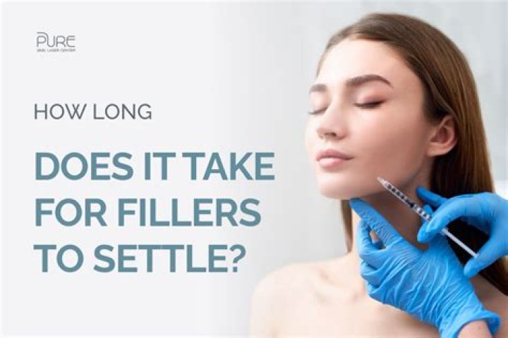 How long does it take for an NFT to sell?