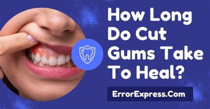 How long does it take for your gums to heal after having all your teeth pulled?