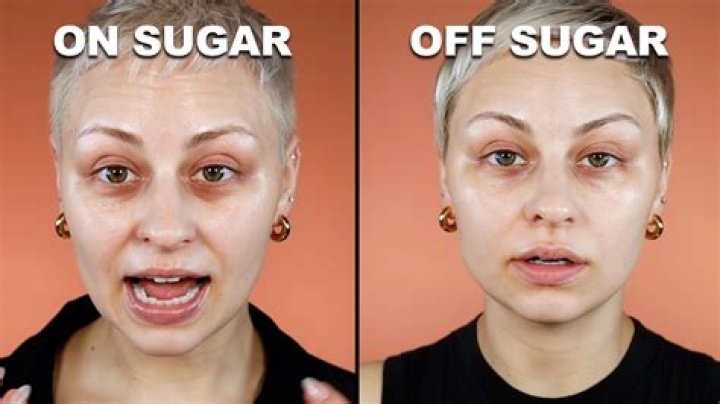 How long does it take for your skin to improve after quitting sugar?