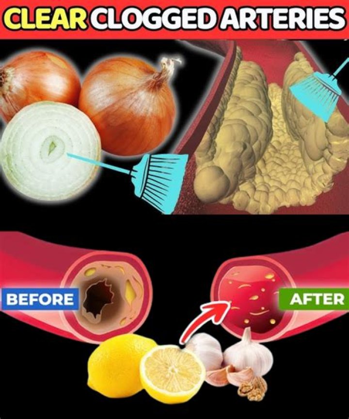 How long does it take to clear arteries of cholesterol?