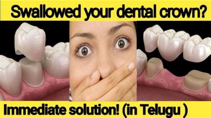 How long does it take to poop out a swallowed tooth?