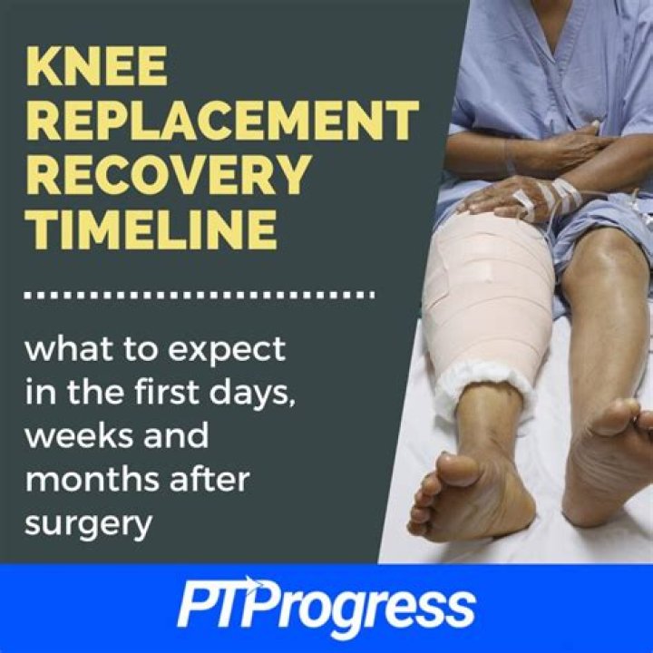 How long does it take to recover from an ICD implant?