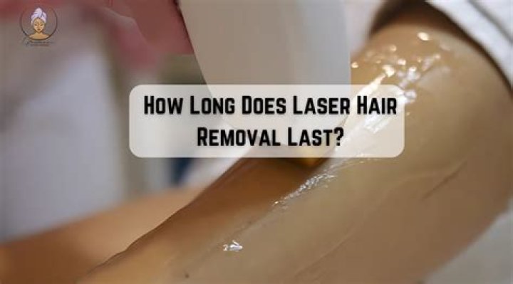 How long does laser last?