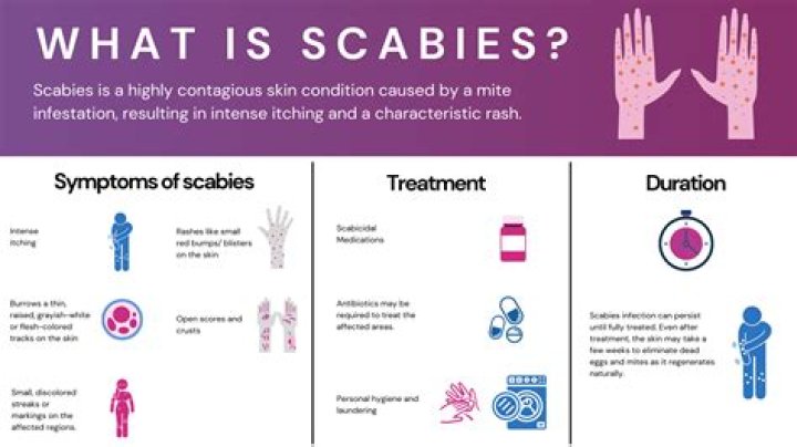 How long should you avoid someone with scabies?