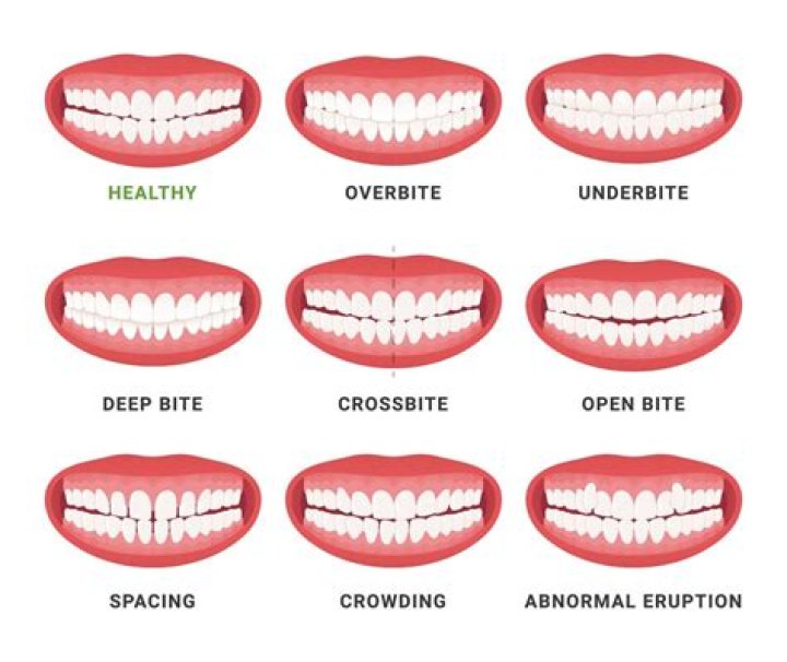 How long should your teeth be?