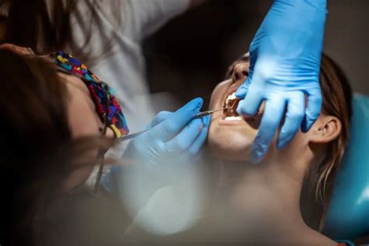 How many times can a tooth be bonded?