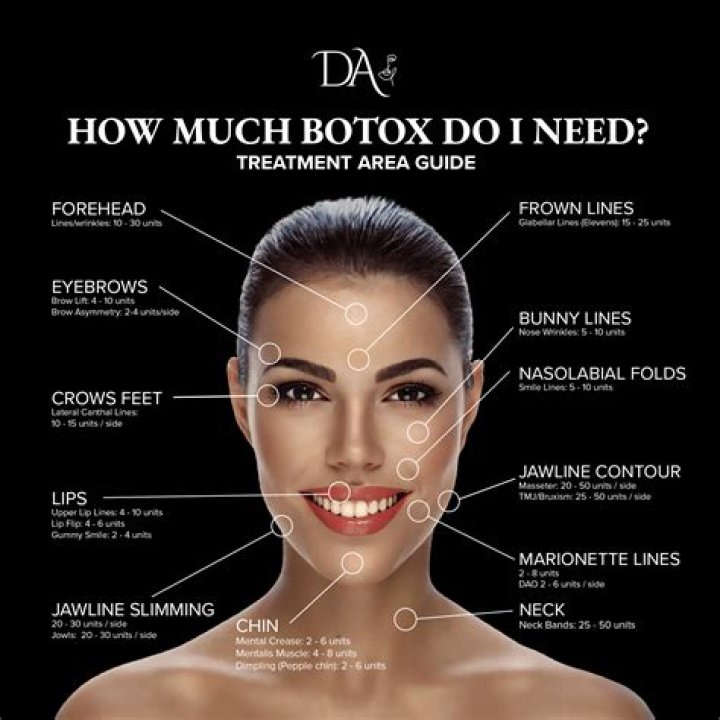 How much does Botox cost?
