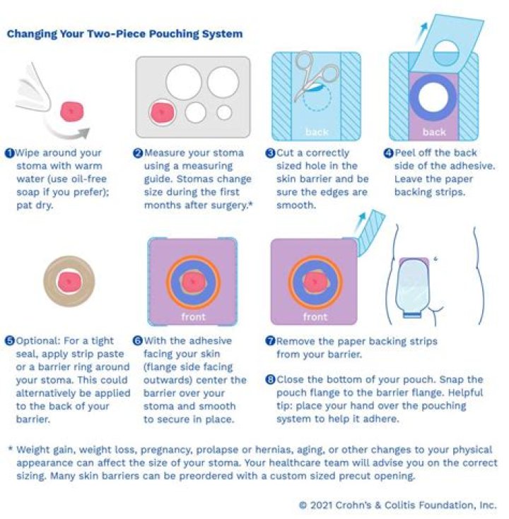 How often do you change colostomy wafer?