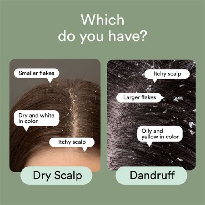 How often should I shampoo if I have dandruff?