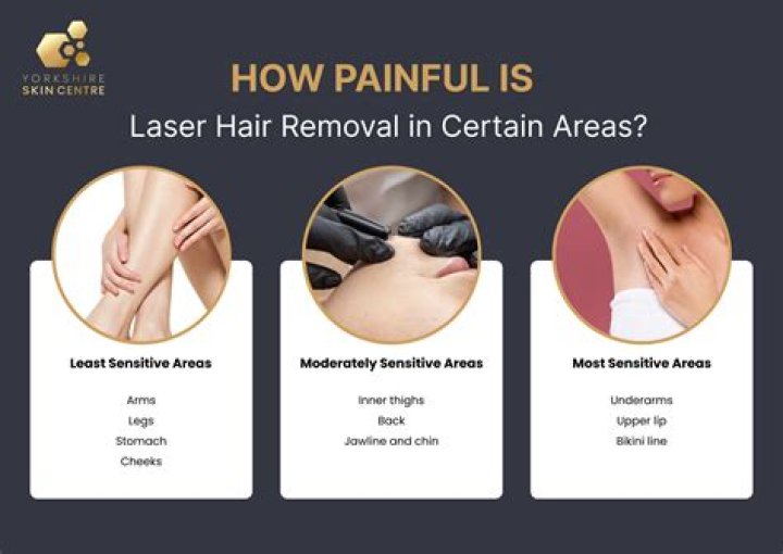 How painful is laser hair removal?