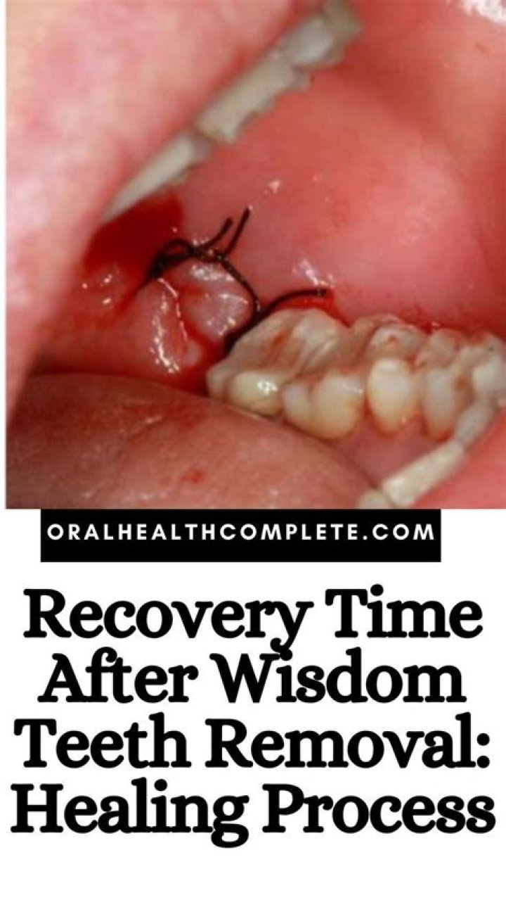 How painful is wisdom teeth removal?