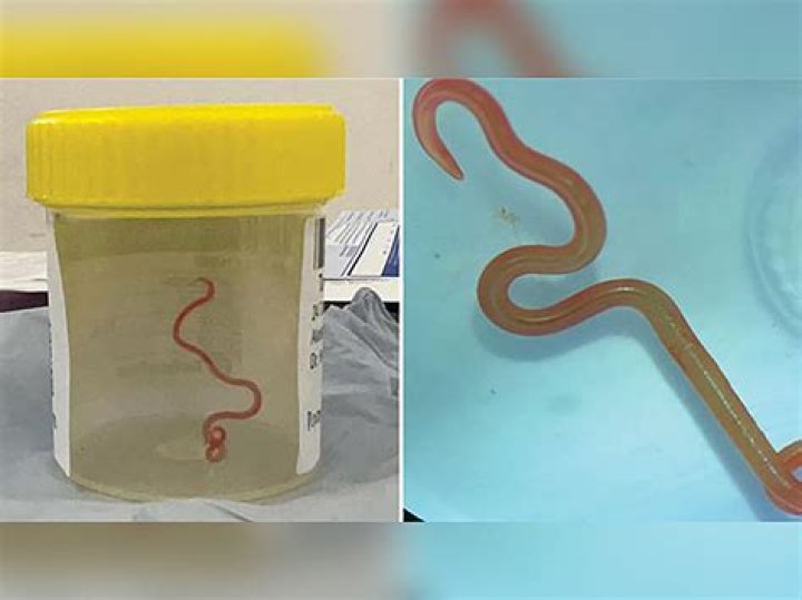 How quickly does worm medicine work?