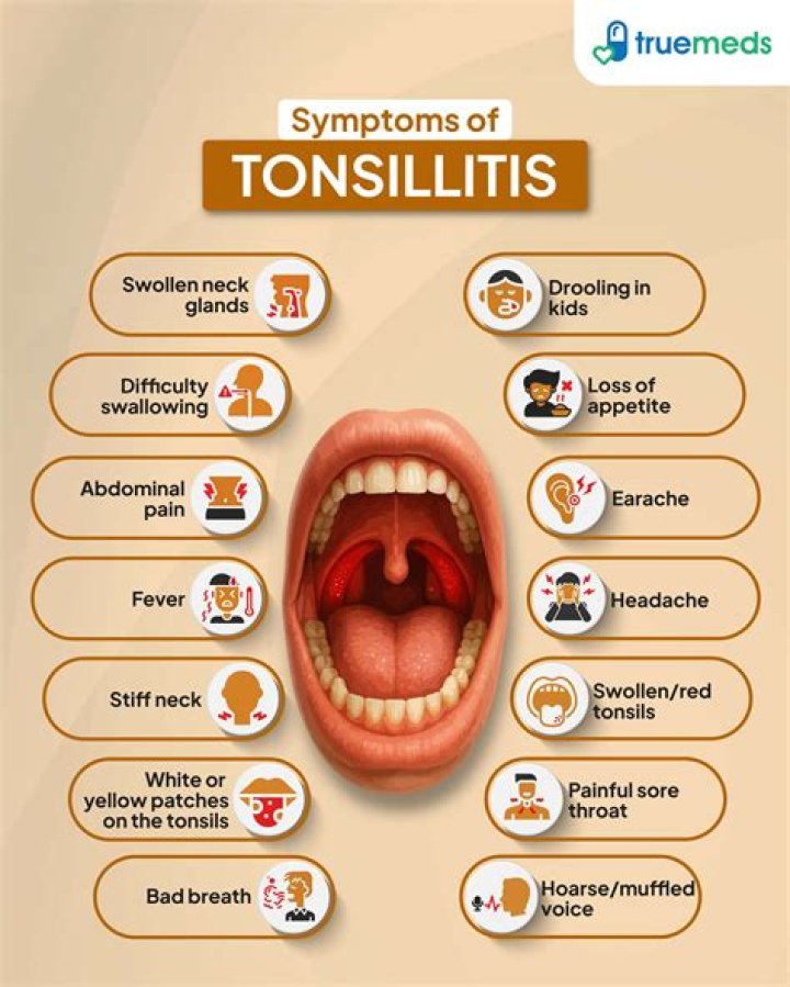 How serious is tonsillitis in adults?